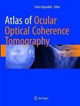 Optical Coherence Tomography of the Anterior Segment | 9783031077296 ...
