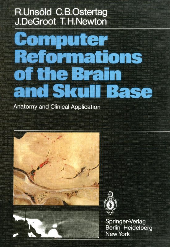 Medicine (R0) - Computer Reformations of the Brain and Skull ... - cover