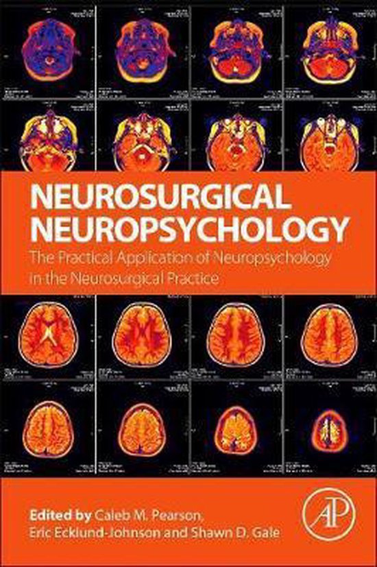 Neurosurgical Neuropsychology 9780128099612 Caleb Pearson Boeken