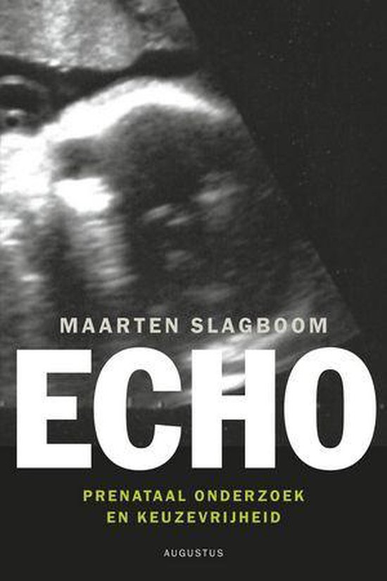Cover van het boek 'Echo' van Maarten Slagboom