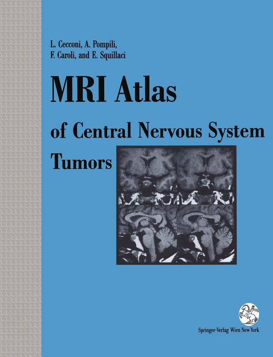 MRI Atlas of Central Nervous System Tumors - cover