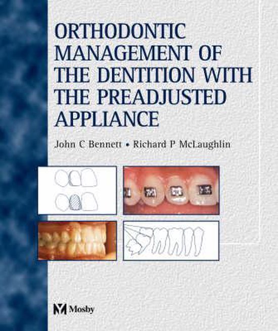 Orthodontic Management of the Dentition with the Preadjusted Appliance
