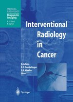Medical Radiology - Interventional Radiology in Cancer