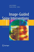 Image-Guided Spine Interventions