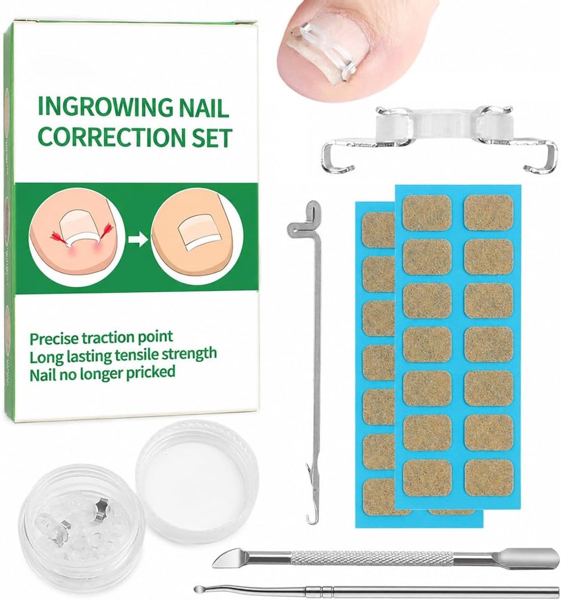 1 Set Ingegroeide Teennagel Correctie, set met gereedschap voor ingegroeide teennagels,v-oor het verwijderen van inge-groeide nagel-s,speciaal ontworpen vo-or het repareren van gebogen nagels