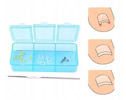Set voor Ingegroeide Teennagels - Professionele Correctie KL6