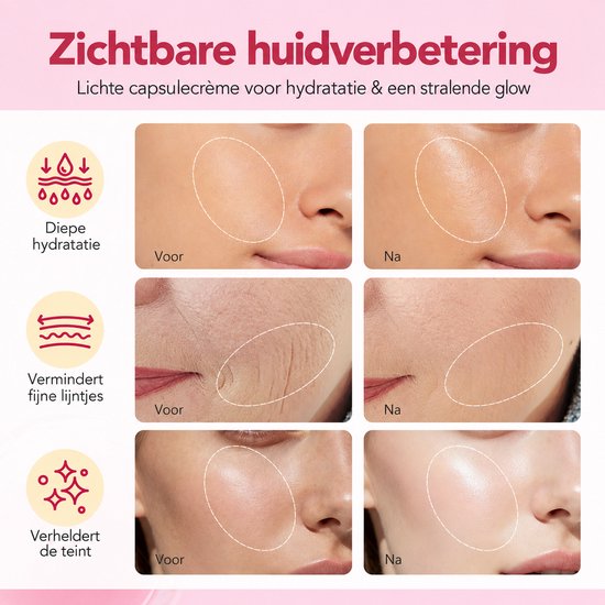 Zes foto's met 'voor' en 'na' resultaten van de ATOANY crème: hydratatie, minder lijntjes en een egalere teint.