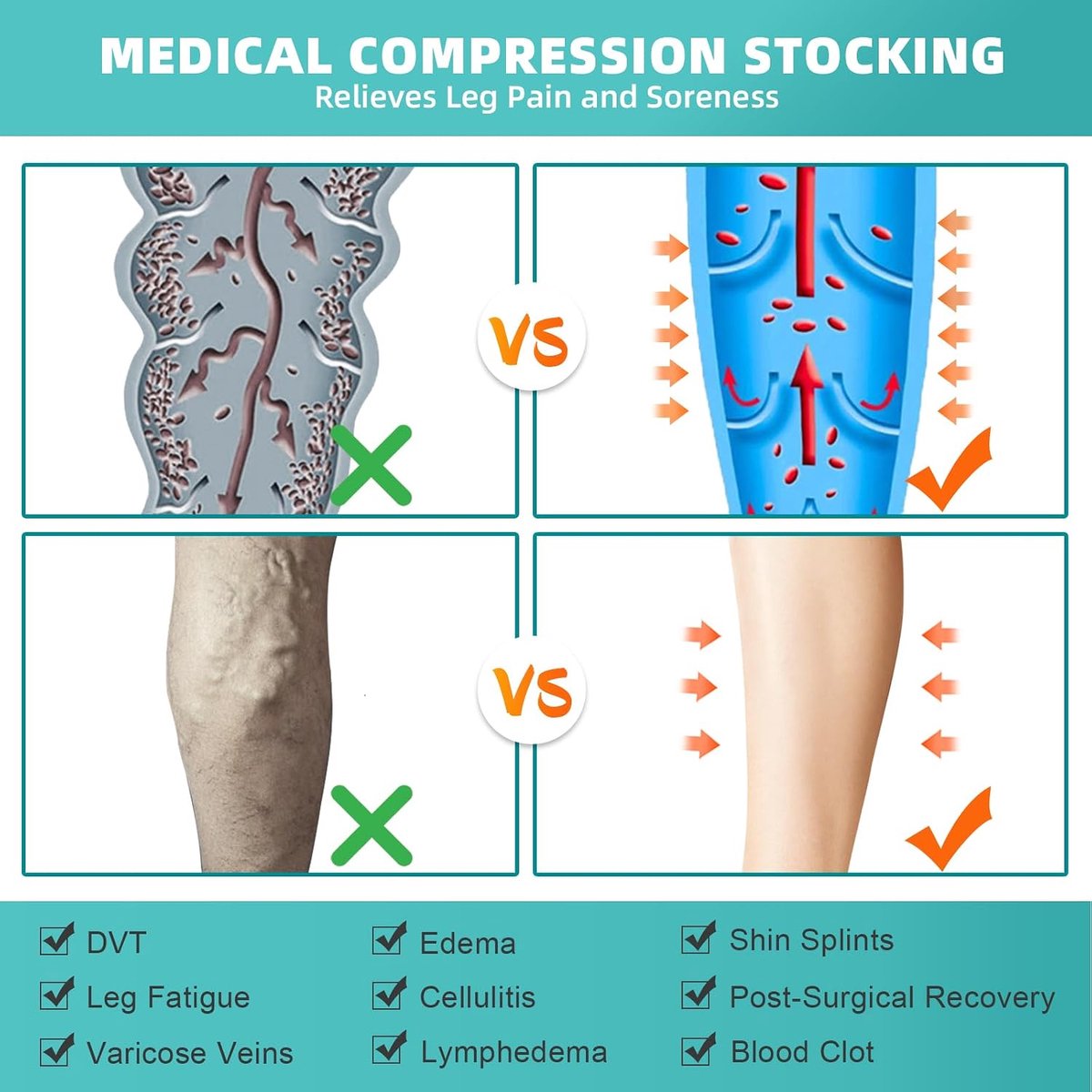 Kousen voor dames en heren, 20-30 mmHg, klasse II, lange steunkousen, compressiesokken voor vliegreizen, gegradueerde ondersteuning bij spataderen