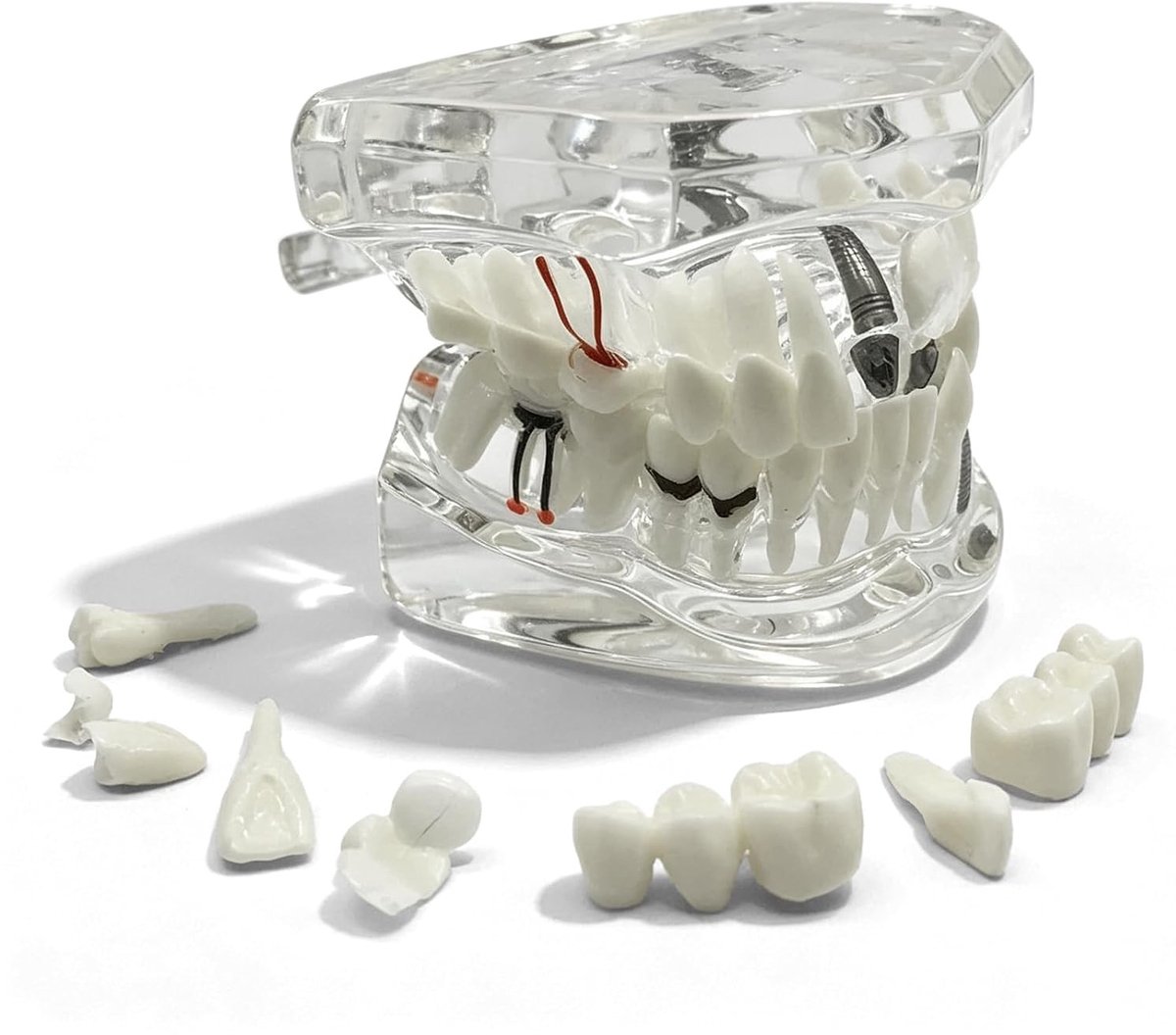 Orthodontisch tandmodel met verwijderbare tanden voor training en educatie in de tandheelkunde, transparant en geschikt voor klinieken