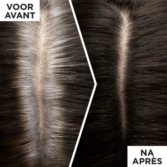 Voor en na foto van grijs haar dat met spray is bedekt, met "VOOR AVANT" en "NA APRÈS" labels.