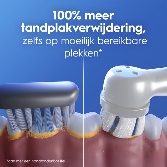 Vergelijking van handtandenborstel en Oral-B iO voor tandplakverwijdering.