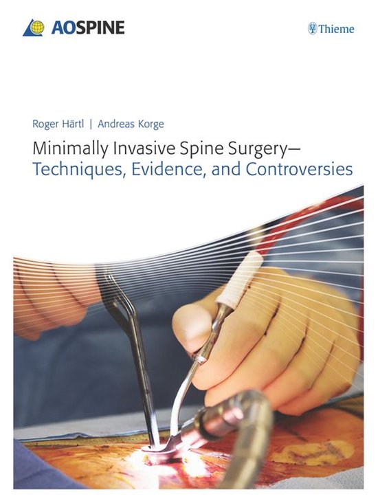 Minimally Invasive Spine Surgery - Techniques, Evidence, and ... - cover