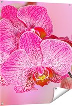 Gards Affiche de jardin Fleurs d'orchidées roses - 80x100 cm - Toile jardin - Décoration de jardin - Décoration murale extérieur - Tableau jardin