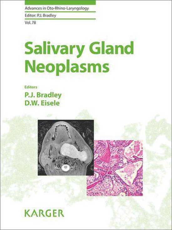 Advances in Oto-Rhino-Laryngology - Salivary Gland Neoplasms