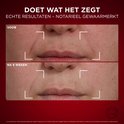 Voor en na 8 weken behandeling: de huid rond de mond toont minder rimpels.