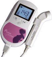 Hart Monitor Baby – Foetale Doppler – Waterbestendig – App – Zwangerschap – Baby – Monitor – Hartslag – LED-scherm – Hartmonitor – Hart