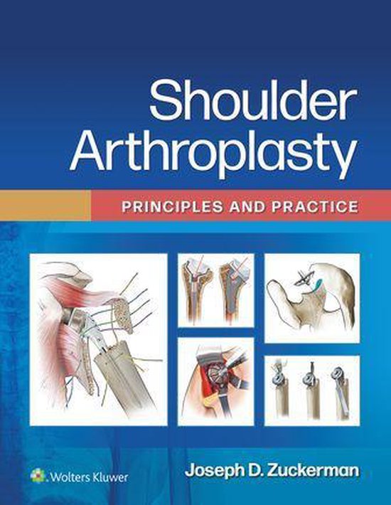 Shoulder Arthroplasty - cover