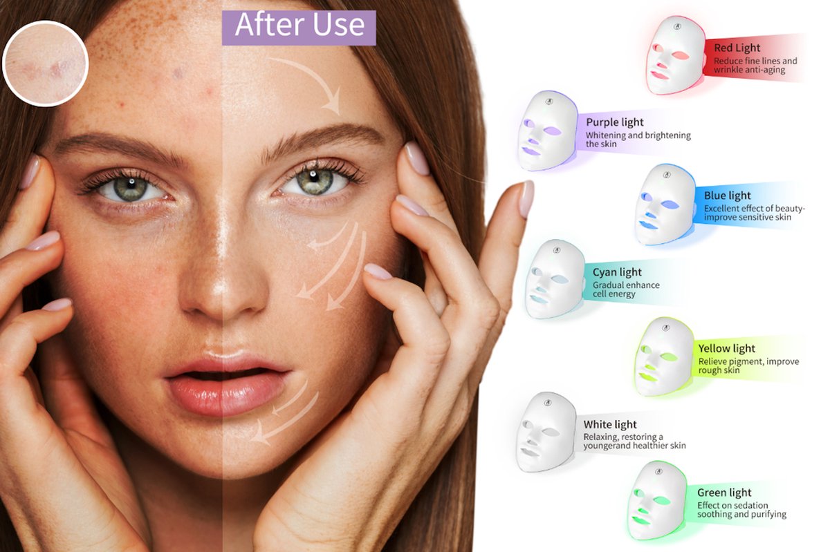 MOSS Gezichtsmasker met Lichttherapie 7 behandelingen Wit