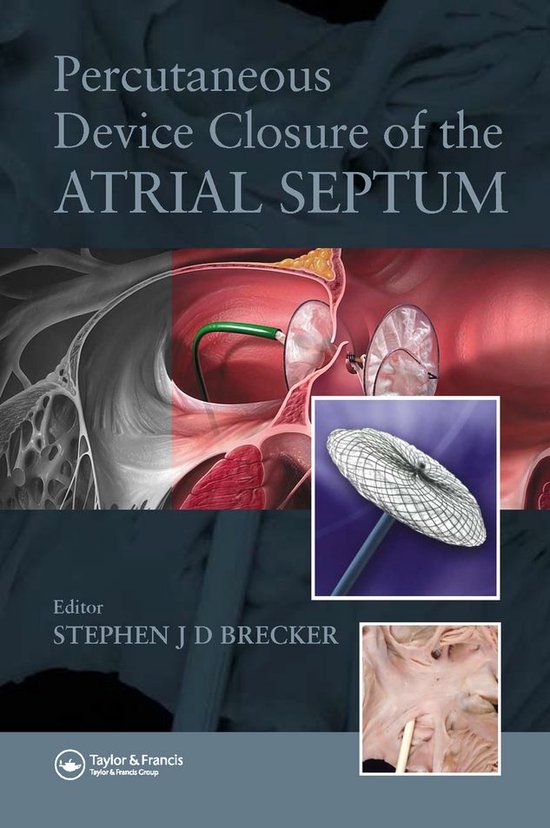 Percutaneous Device Closure of the Atrial Septum (ebook ...