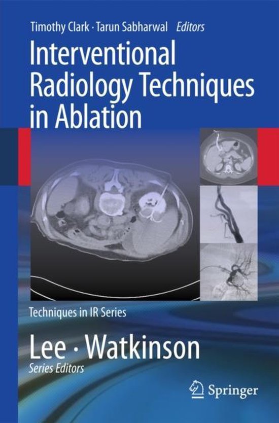 Foto: Interventional radiology techniques in ablation