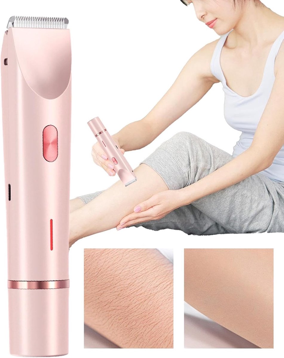 Trimmer voor het gezicht voor dames, trimmer voor dames – krachtige ontharingsapparaat of droog ontharingsapparaat voor het hele lichaam