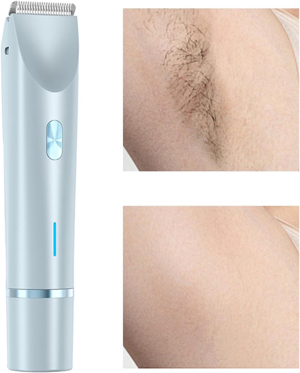 Trimmer voor het gezicht voor dames, trimmer voor dames – krachtige ontharingsapparaat of droog ontharingsapparaat voor het hele lichaam