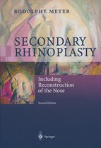 Secondary Rhinoplasty