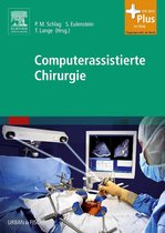 Computerassistierte Chirurgie