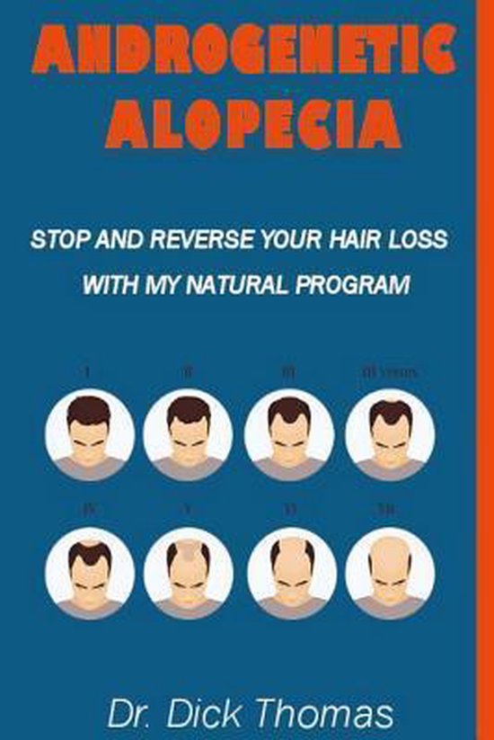 Alopecia naturally androgenetic reverse 15 Home
