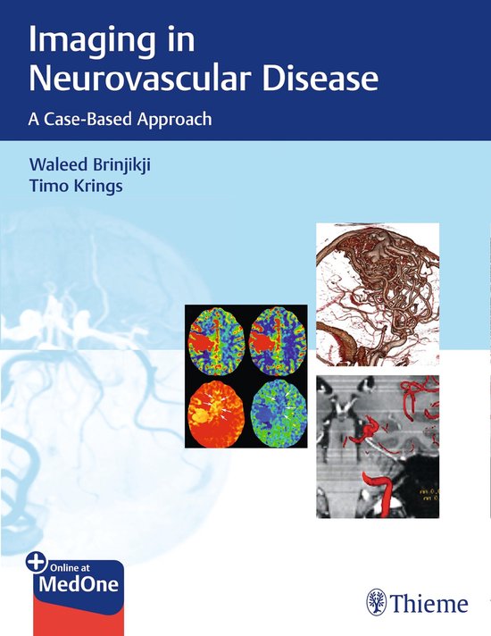 Imaging in Neurovascular Disease - cover