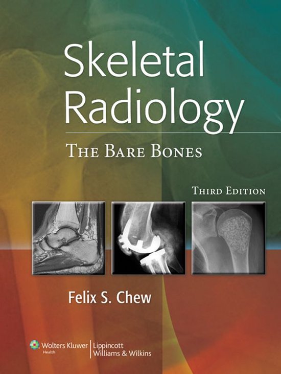 Skeletal Radiology (ebook), Felix S. Chew 9781451148220 Boeken