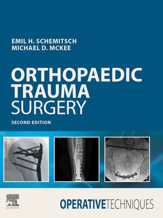 Operative Techniques - Operative Techniques: Orthopaedic Tra ... - cover