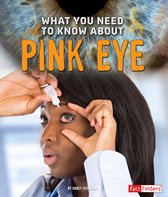 Focus on Health - What You Need to Know about Pink Eye