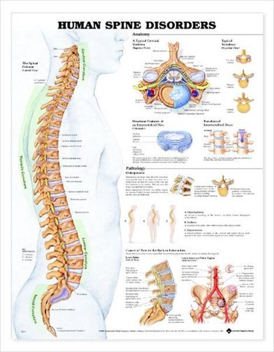 Human Spine Disorders Anatomical Chart - cover