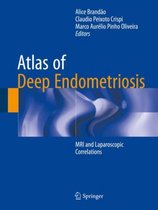 Atlas of Deep Endometriosis