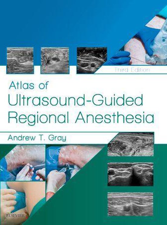 Atlas of Ultrasound-Guided Regional Anesthesia E-Book - cover