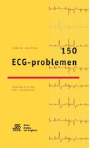 150 ECG-problemen