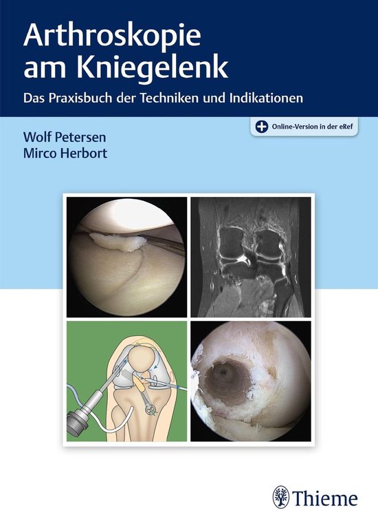 Arthroskopie am Kniegelenk - cover