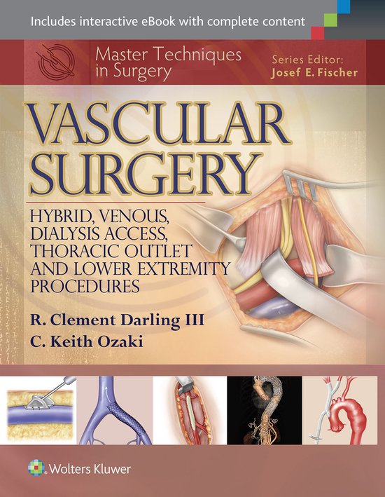 Master Techniques In Surgery Vascular S - cover