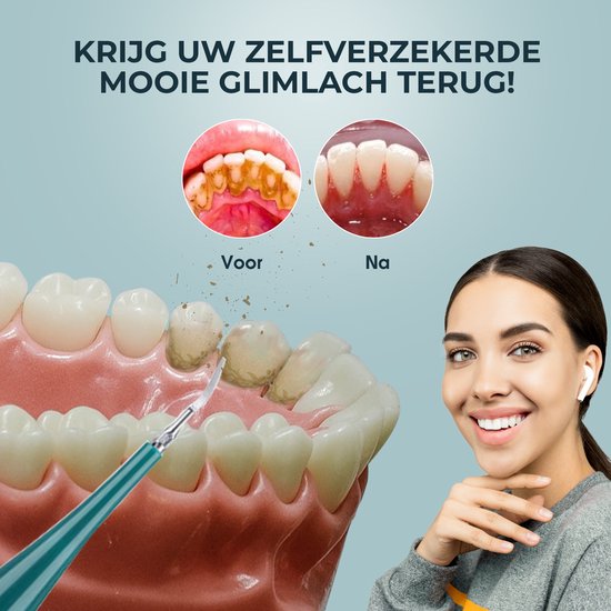Tandsteen Verwijderaar Elektrisch Dentect – Tandenborstel Opzetstukken -  Tandarts... | Bol.Com