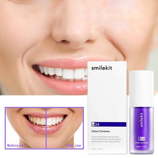 Smilekit® V34 Colour Corrector Serum - Tandenverheldering met ...