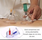IBBO® - Chinese Cupping - Vacuum cups - Massage - Cupping Set - Cupping Set Massage - Cups - Set 12-Delig
