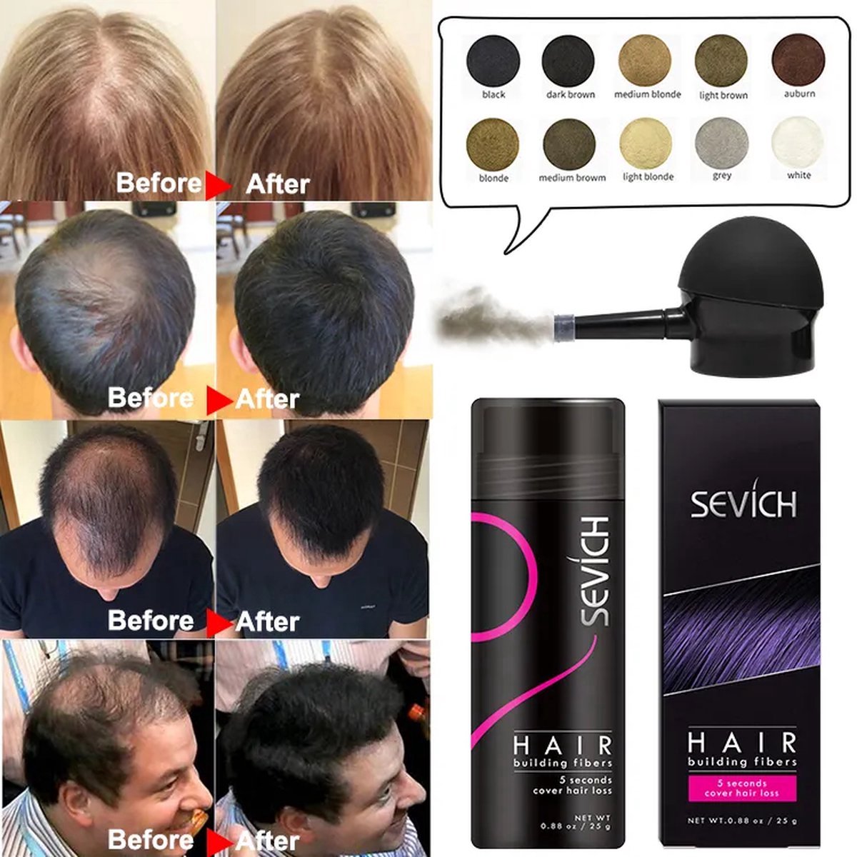 3 in 1 Kit hair fixing spray / Spray Applicator / Hair Fiber powder 25g Set
