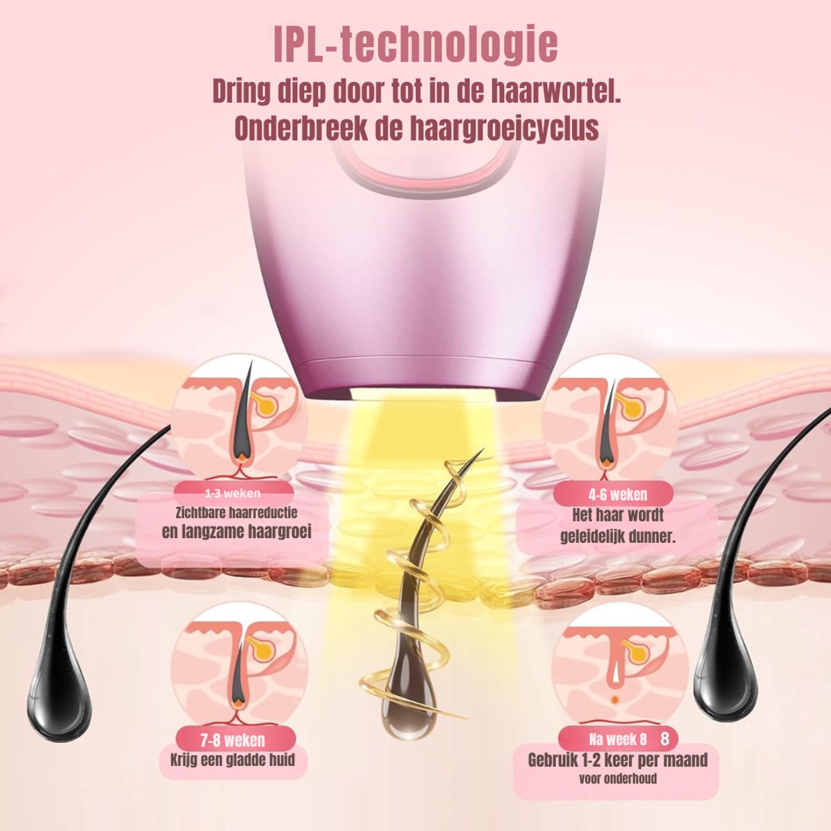 TIM® Laser Ontharingsapparaat - Laser Ontharing - Wit - 24cm x 18cm x 9cm thumbnail 2