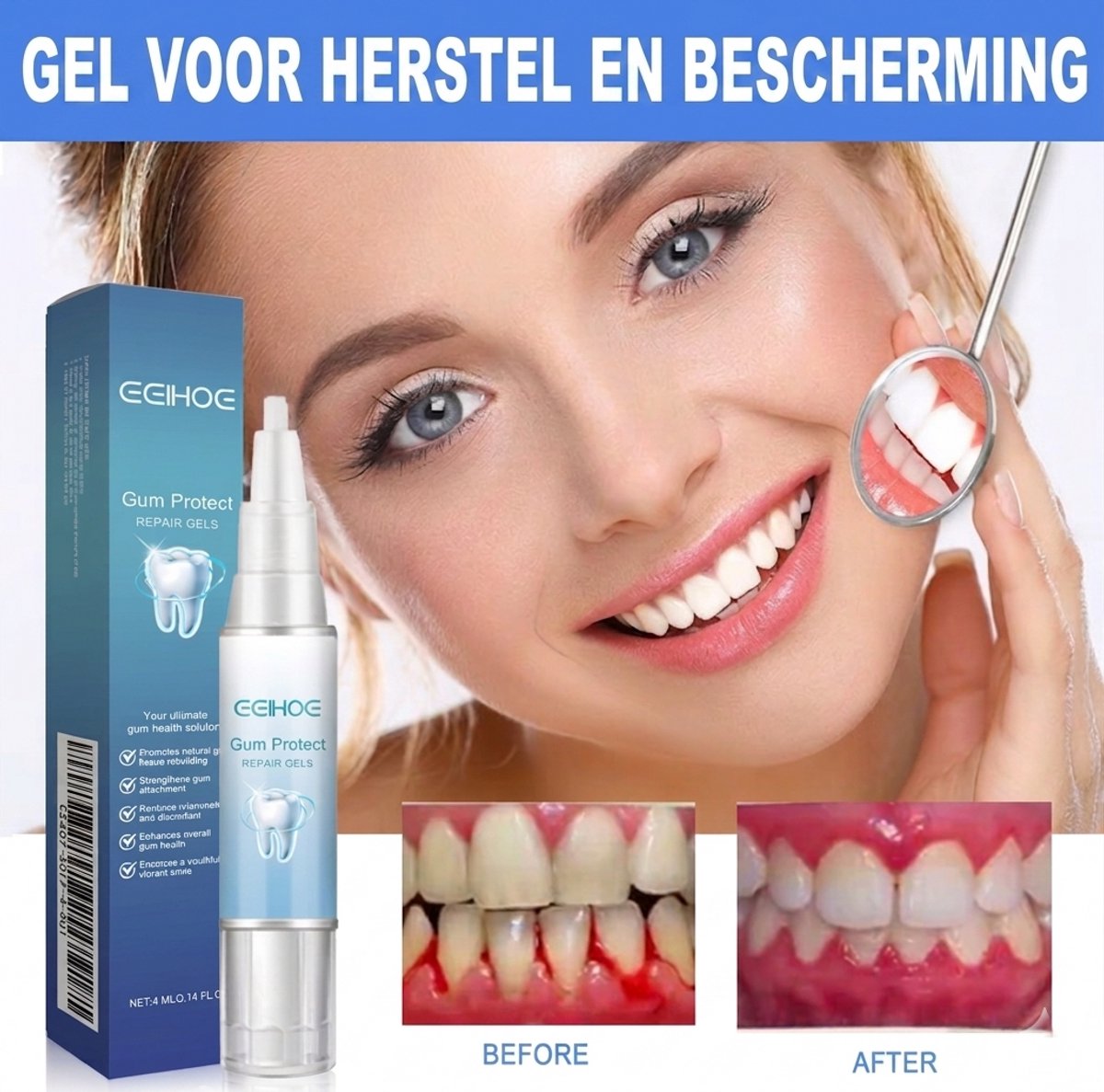Eelhoe Tandvlees Herstel Gel - Tegen Terugtrekkend & Gevoelig Tandvlees - Diepe Reiniging & Anti-Tandsteen - Mondverzorging Gel - 4 ml