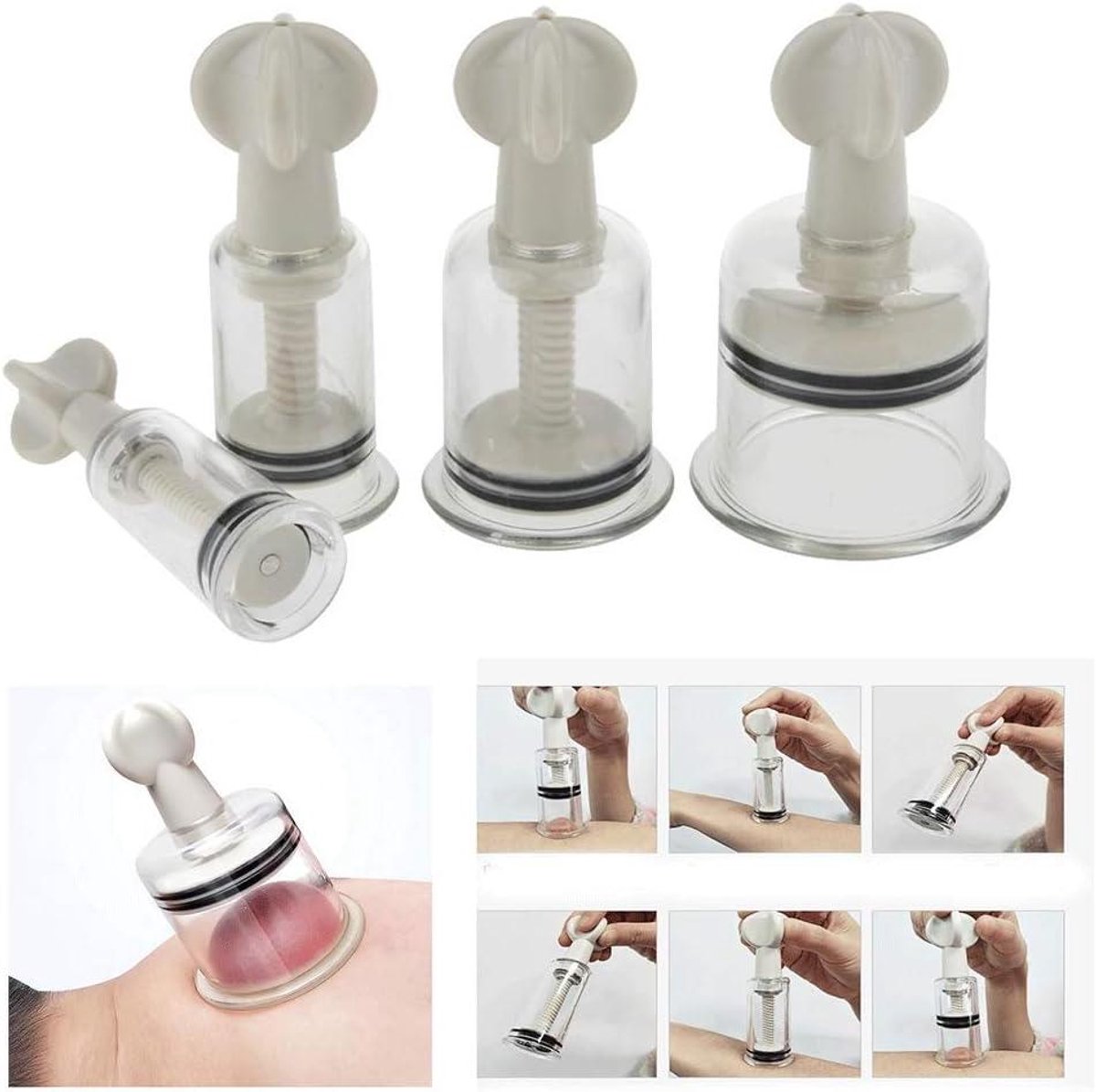 Massage Cupping Set - Vacuüm Cups - Lichaamsmassage - Roterend Schroefontwerp - 4 stuks - Transparant