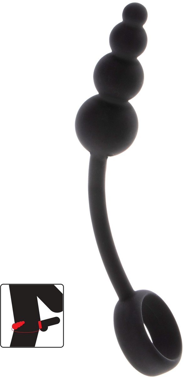 Anale Plug & Penisring