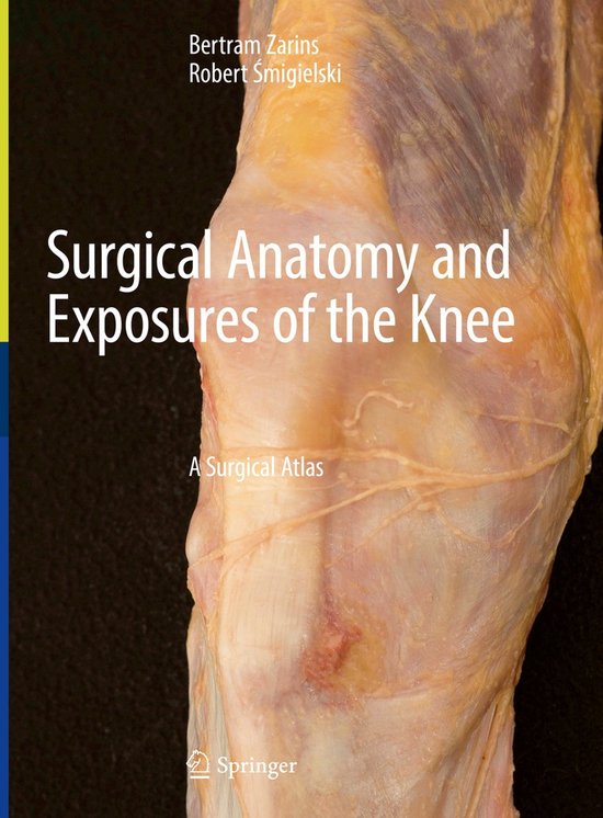 Surgical Anatomy and Exposures of the Knee - cover