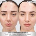 Voor en na foto's van een vrouw met puistjes, behandeld met Garnier PureActive Invisible Pimple Patch. Links vóór, rechts na 8 uur.