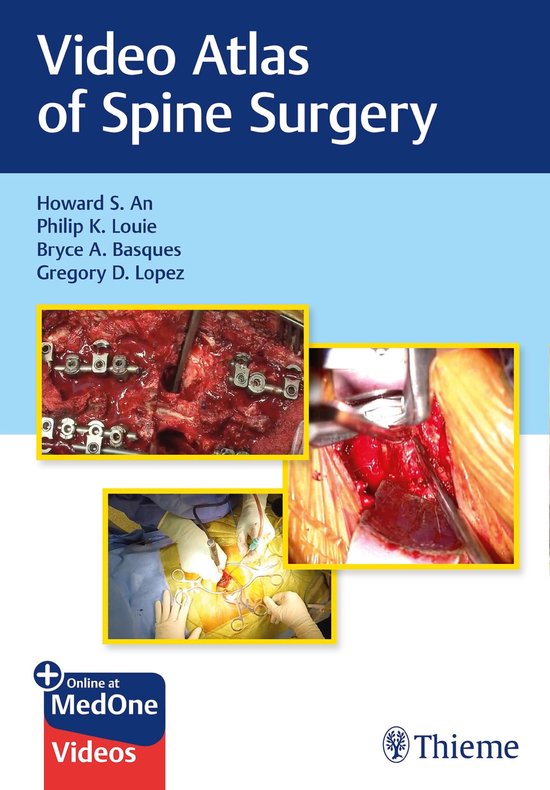 Video Atlas of Spine Surgery - cover